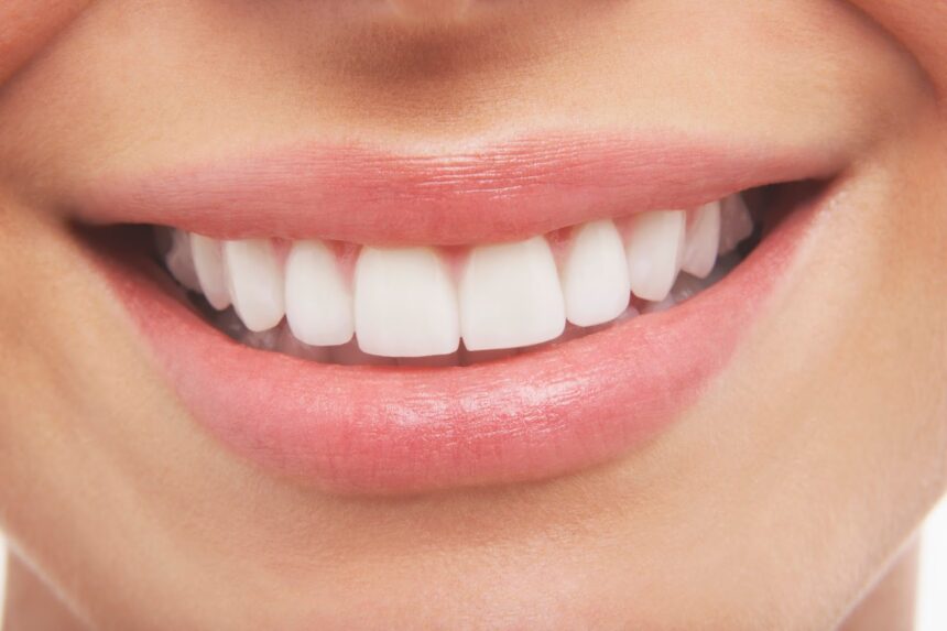 Composite Bonding and Clear Braces in Leicester